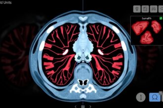 CT-vizsgálat Hounsfield-egységekkel, a szövetek azonosításához.